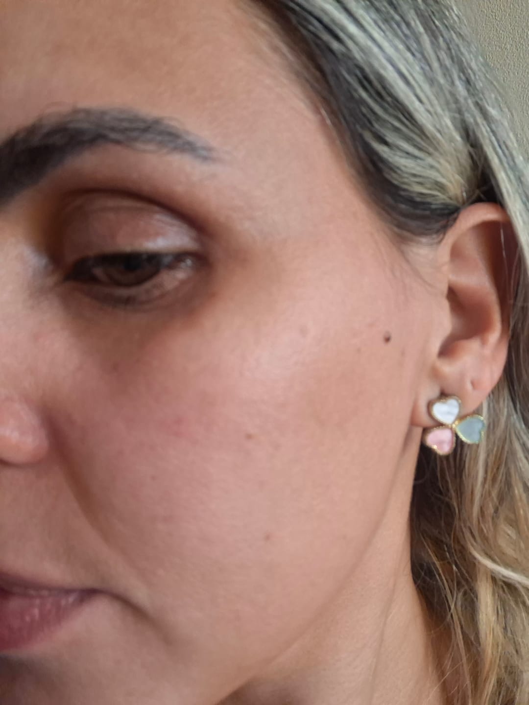 Customer photo review of Creme Clareador de Manchas – Melasma, Axilas, Virilha, Áreas Íntimas, Rosto e Corpo