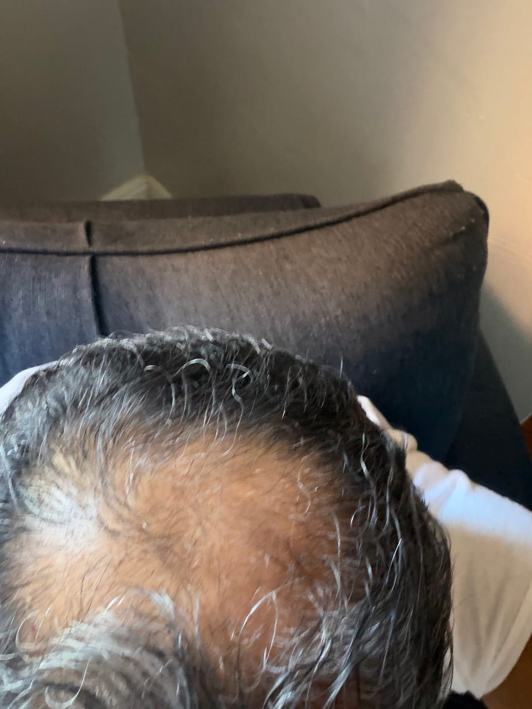 Customer photo review of Spartan™ Root Activator Shampoo 3 Bottles(sc)
