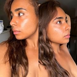 Customer photo review of GlutaLumi™ Brightening Serum