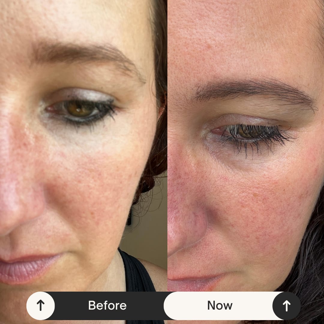 Customer photo review of EYELASH GROWTH SOLUTION