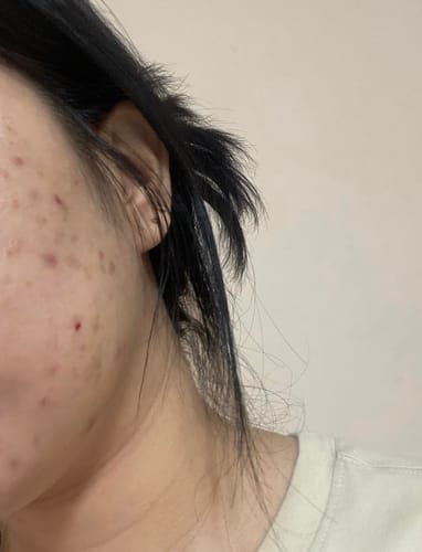 Customer photo review of Kit Facial RENEW