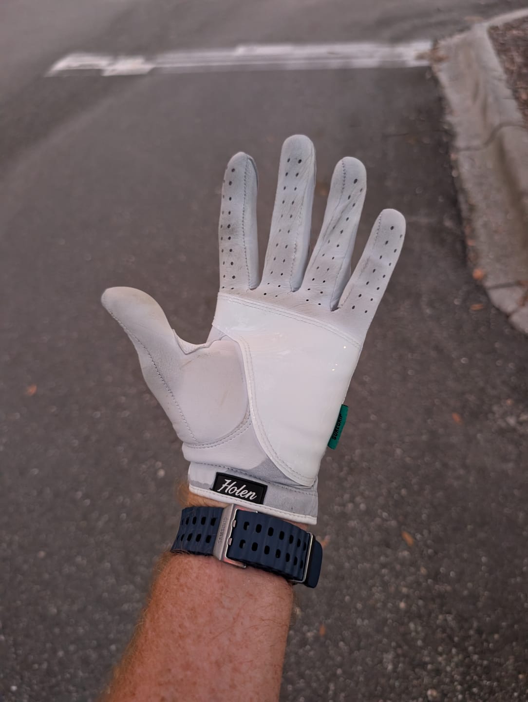 Customer photo review of Holen SureGrip Glove