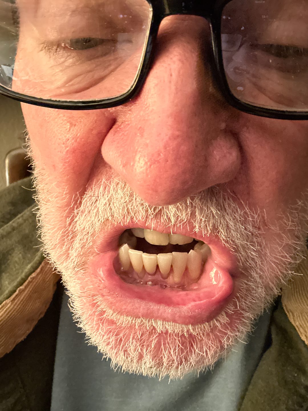 Customer photo review of LIVFRESH Wintergreen - 1 Pack (Subscription)