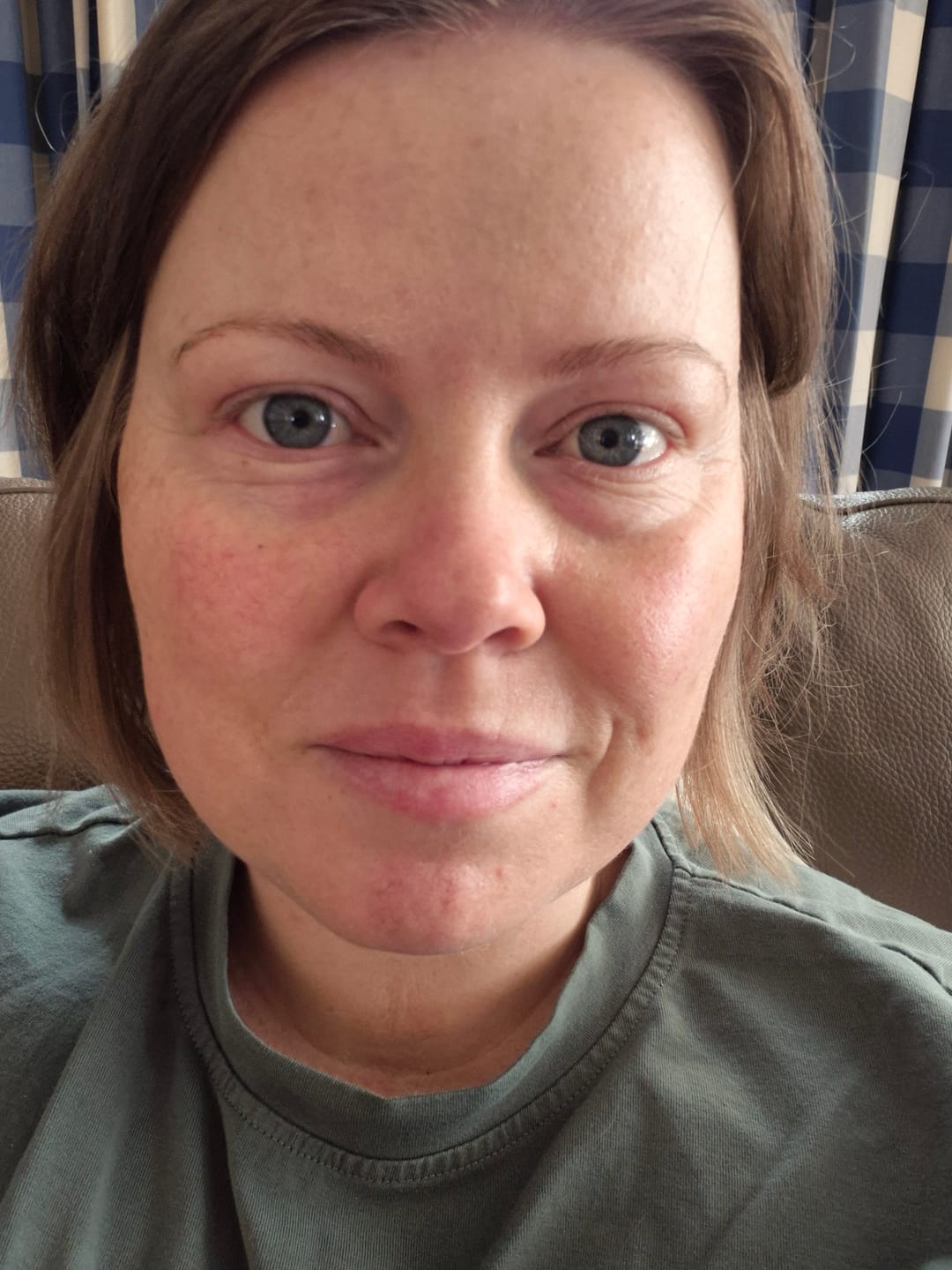 Customer photo review of Combination Skin Set