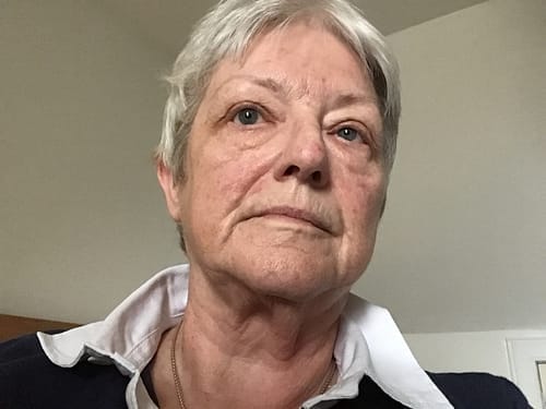 Customer photo review of Rosalique Ultimate Cream Duo