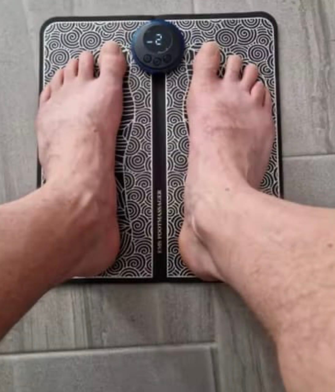 Customer photo review of Estimulador EMS para Piernas Hinchadas