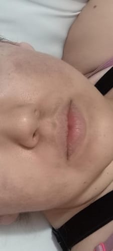 Customer photo review of Serum Facial Ácido Hialurónico 50ml