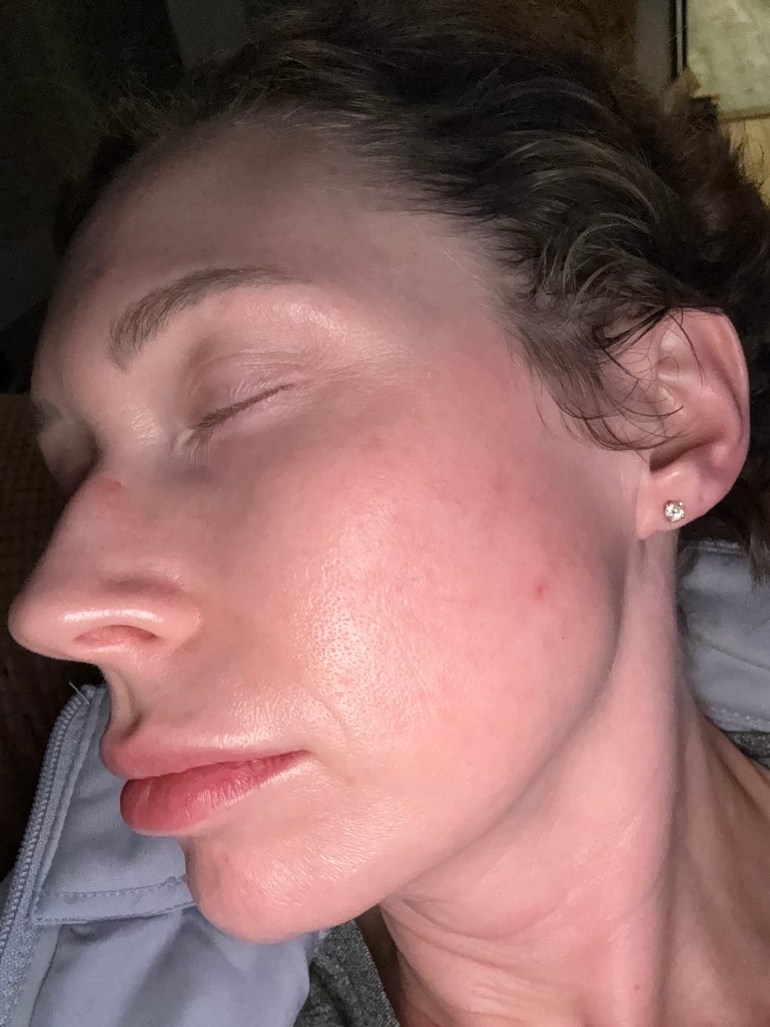 Customer photo review of Blue EGF Intensive Pro Cream