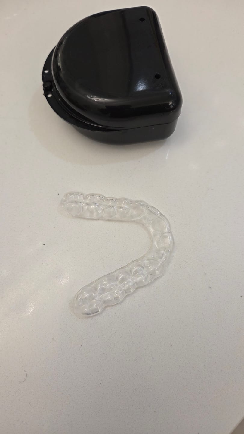 Customer photo review of File Your Smile (A Digital Copy of Your Impressions For Future Replacement Products)