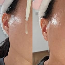 Customer photo review of GlutaLumi™ Brightening Serum