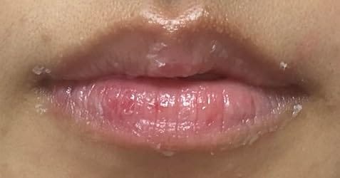 Customer photo review of ChillPlump™ Lip Mask