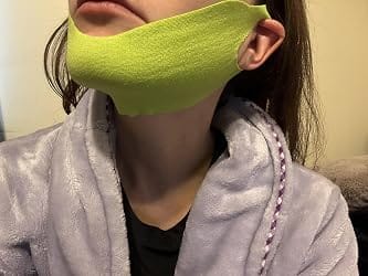 Customer photo review of CactiLift™ V-Face Mask