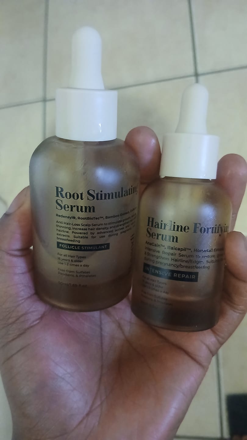 Customer photo review of Hair & Hairline Growth Serum Set