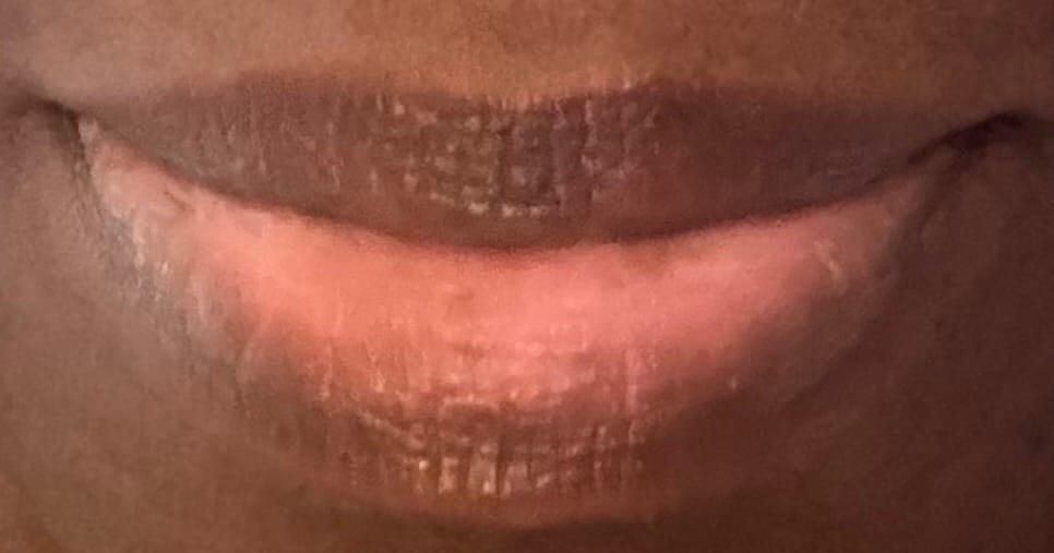 Customer photo review of Overnight recovery for dry, sensitive lips