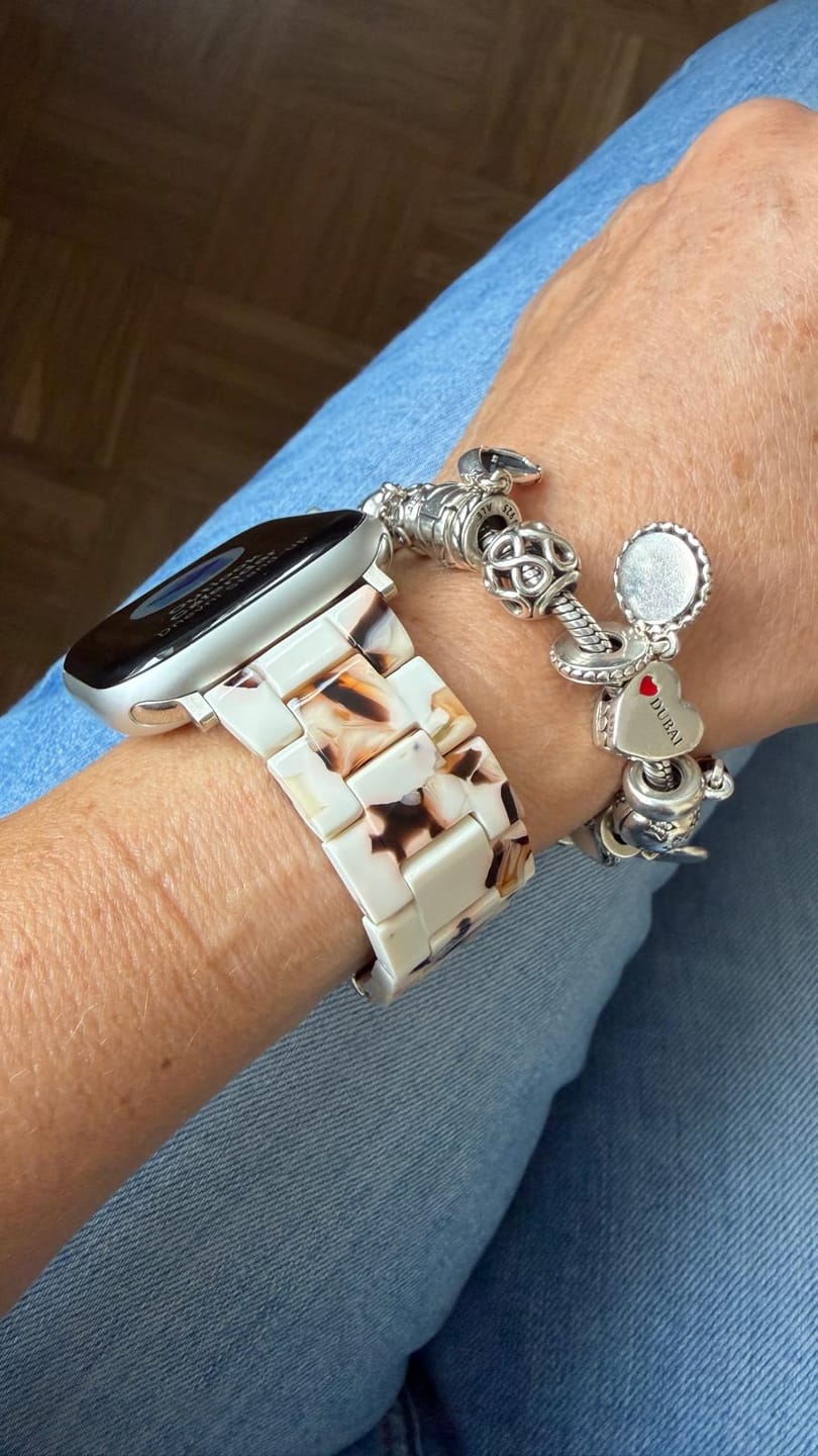 Customer photo review of Perla Ceramic Strap