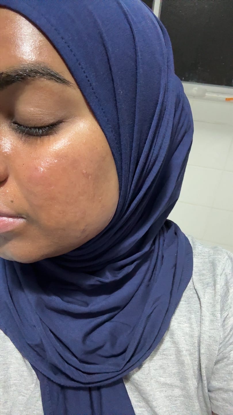 Customer photo review of Turmeric Glow Duo