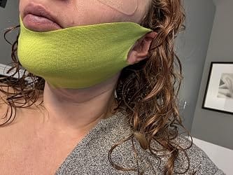 Customer photo review of CactiLift™ V-Face Mask