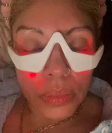 Customer photo review of PHISMA™ Luz Roja 630 nm + EMS para el contorno de ojos