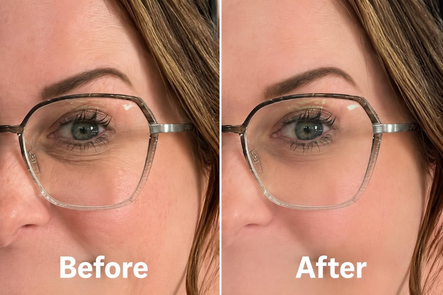 Customer photo review of Organix™ - Instant Puffy Under Eye Bag Remover Cream