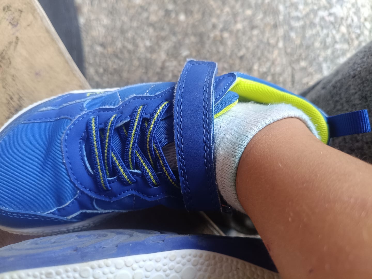 Customer photo review of Acid Cobalt Kids 💦