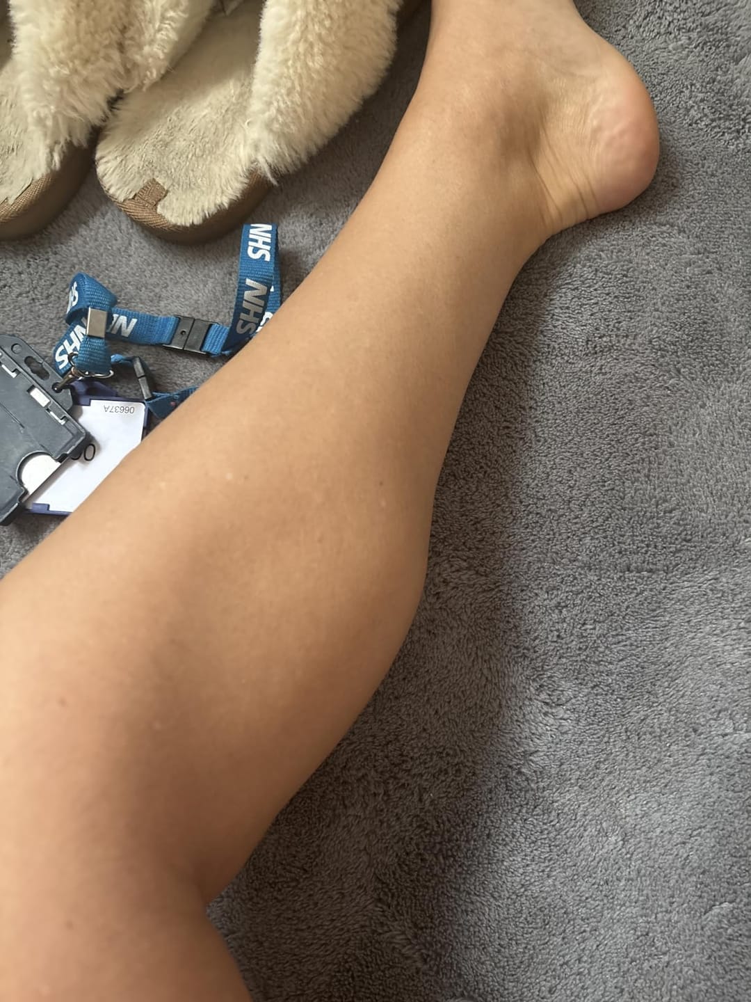 Customer photo review of Glycolic Acid Body Stick