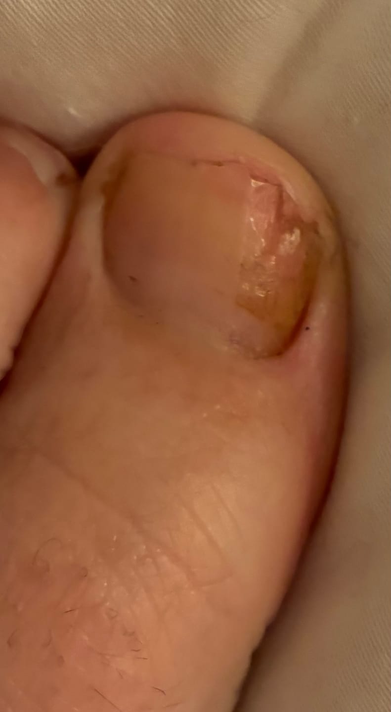 Customer photo review of Fungal Freedom