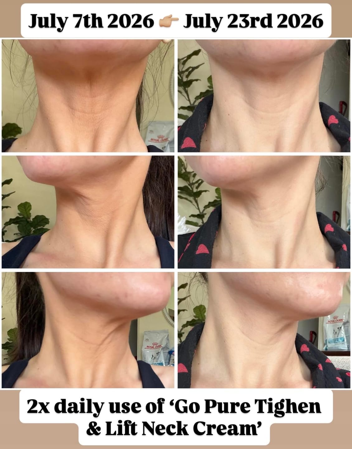 Customer photo review of Organix™ - Tighten & Lift Neck & Chest Moisturizer Cream