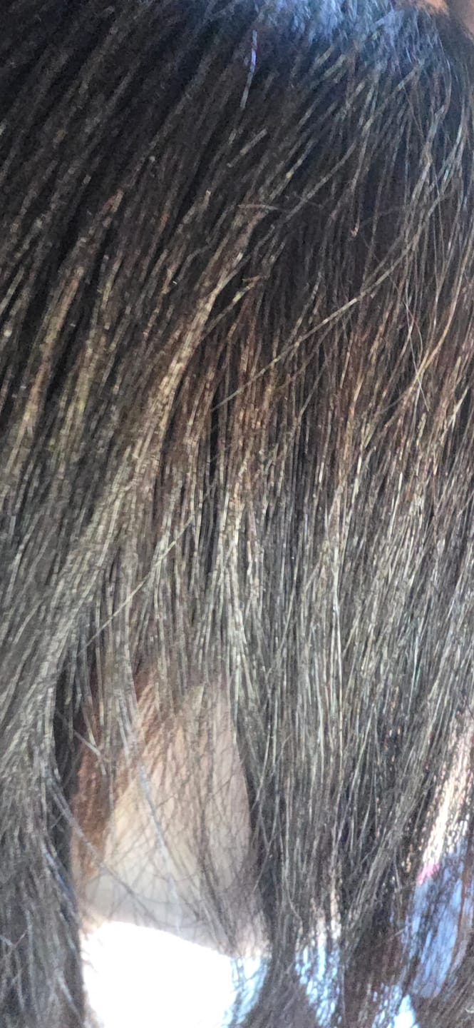 Customer photo review of Sorali Therapy Liss No Frizz Brazilian Keratin Intense Straightening - 1L/33 fl oz