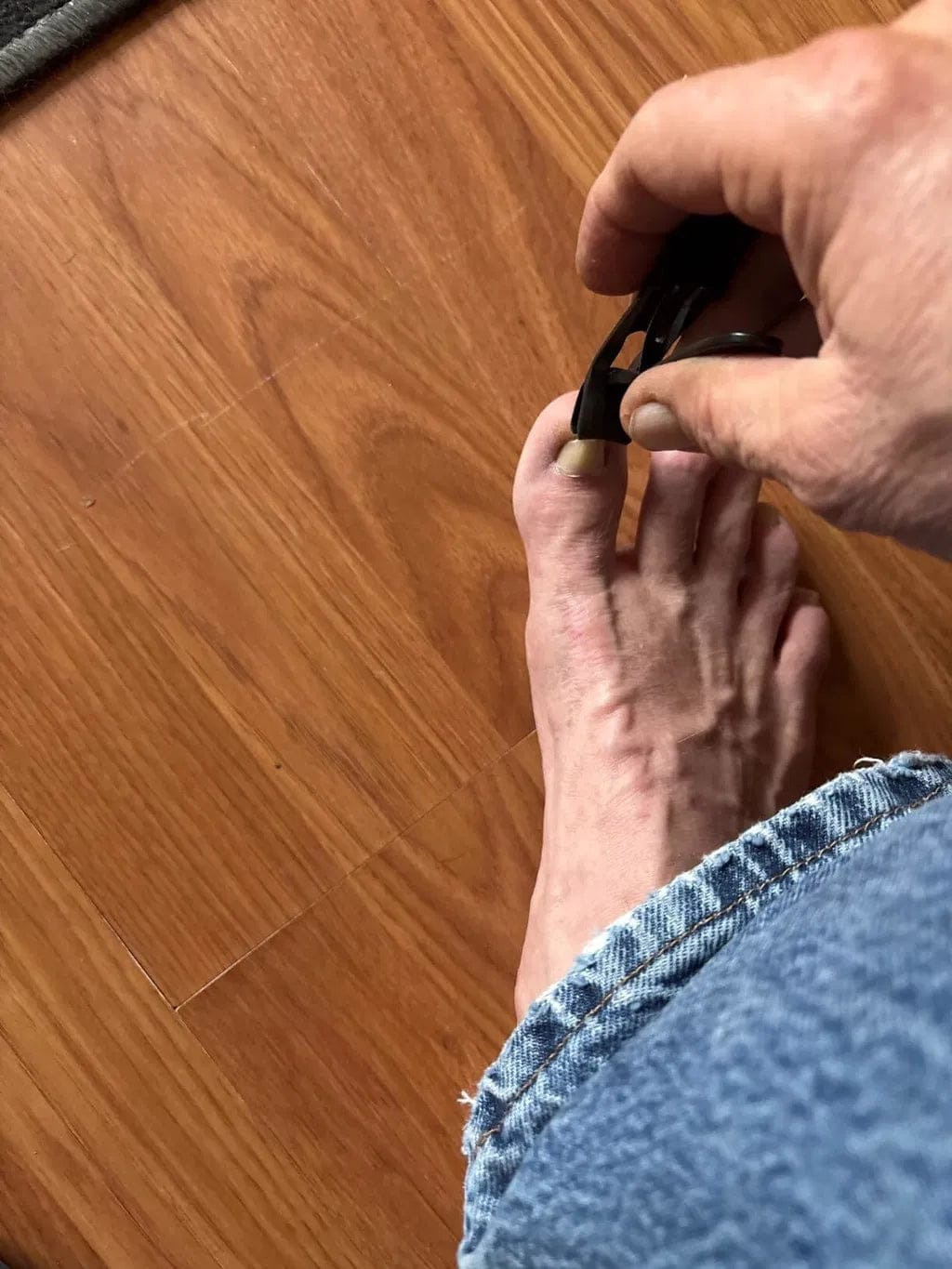 Customer photo review of Mesorto™ Kalın ve Sert Tırnaklara Özel Çelik Makas