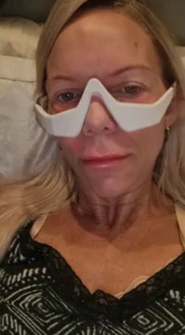 Customer photo review of PHISMA™ Luz Roja 630 nm + EMS para el contorno de ojos