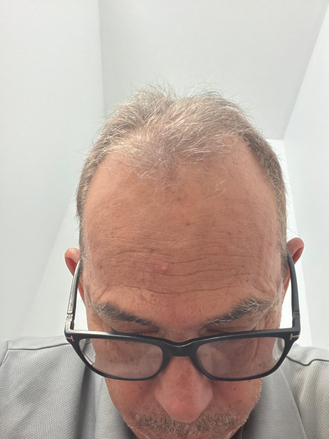 Customer photo review of Spartan™ Root Activator Shampoo 3 Bottles(sc)