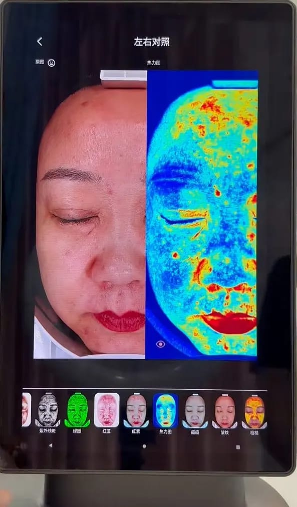 Customer photo review of DermaScope AI Skin Analysis System