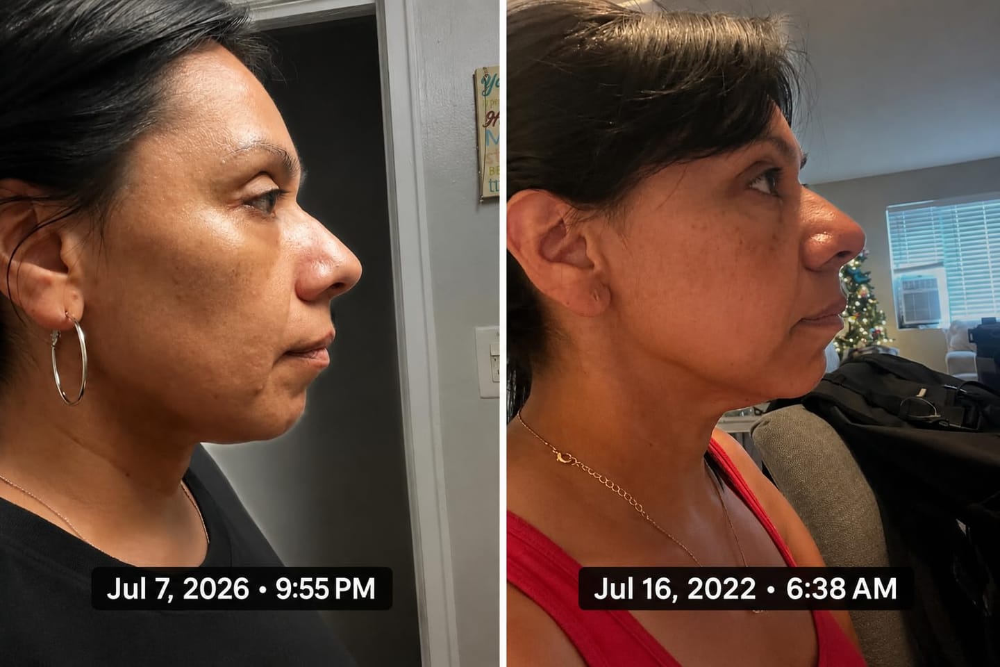 Customer photo review of Organix™ - Tighten & Lift Neck & Chest Moisturizer Cream
