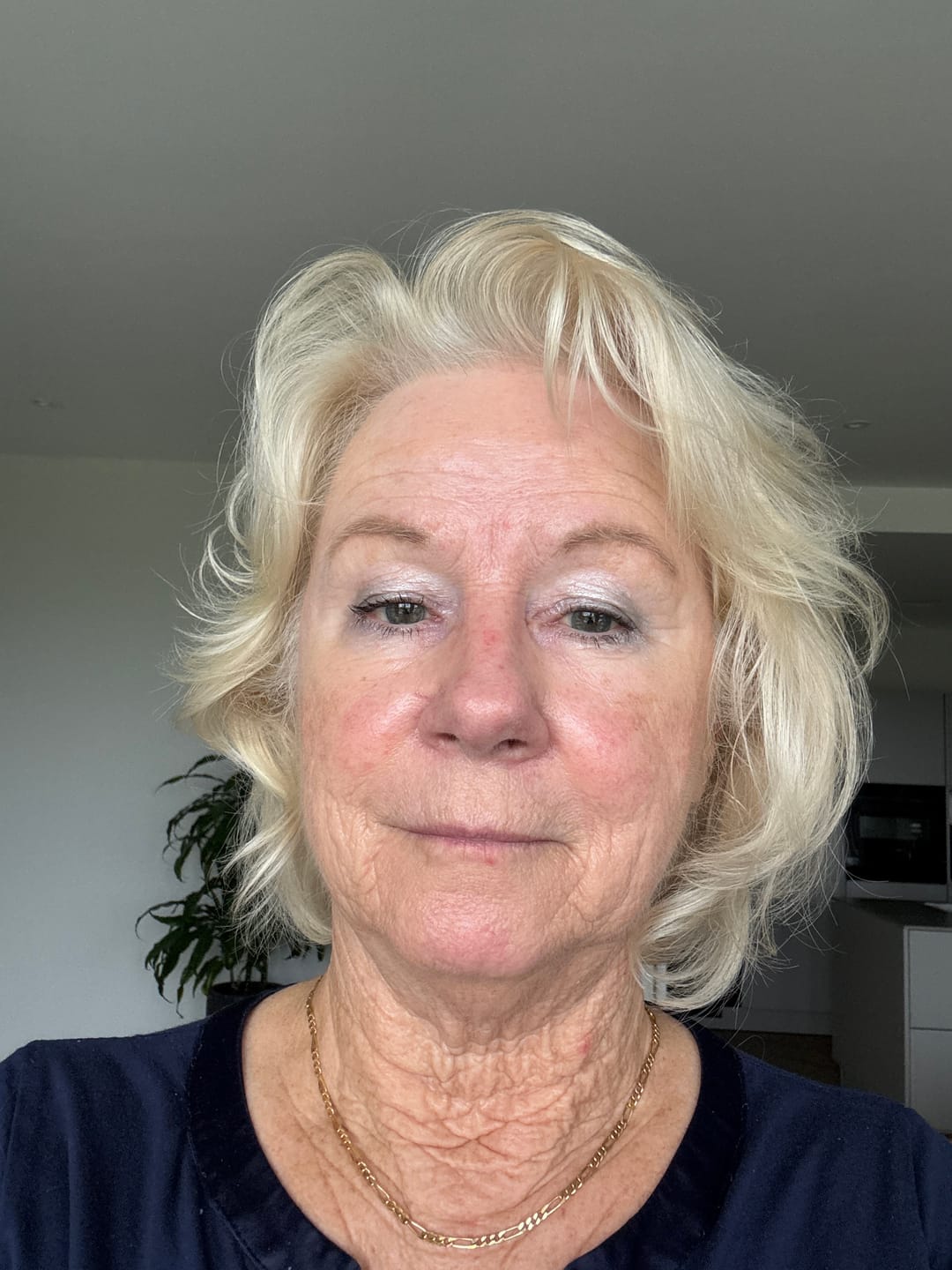 Customer photo review of Anti-Aging Set