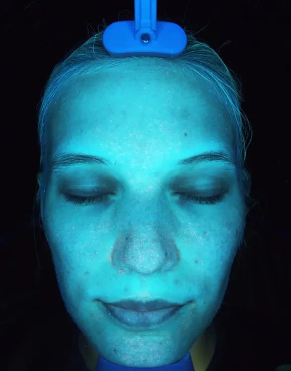 Customer photo review of DermaScope AI Skin Analysis System