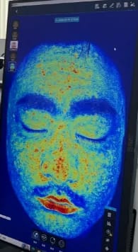 Customer photo review of DermaScope AI Skin Analysis System