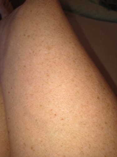 Customer photo review of Tetyana Naturals Body Oil