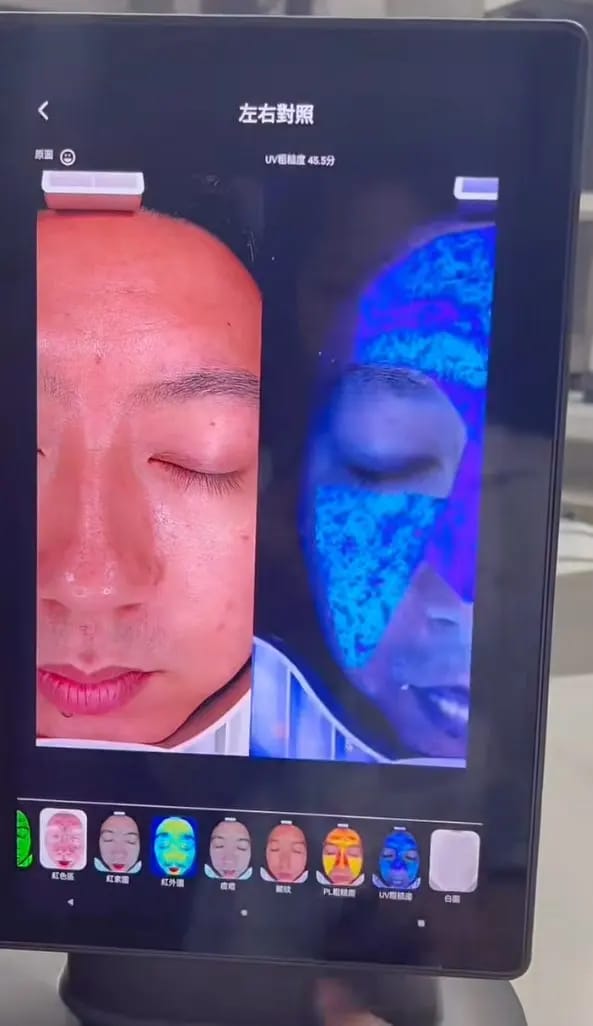 Customer photo review of DermaScope AI Skin Analysis System