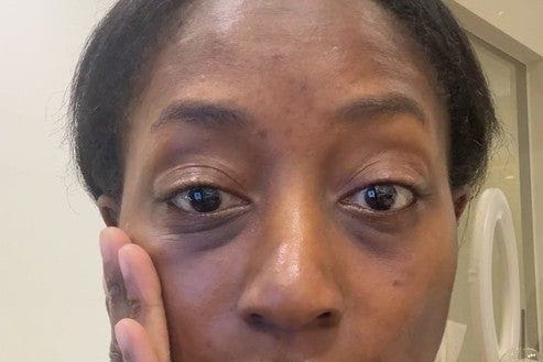 Customer photo review of Dr. Melaxin Collagen Boost Set