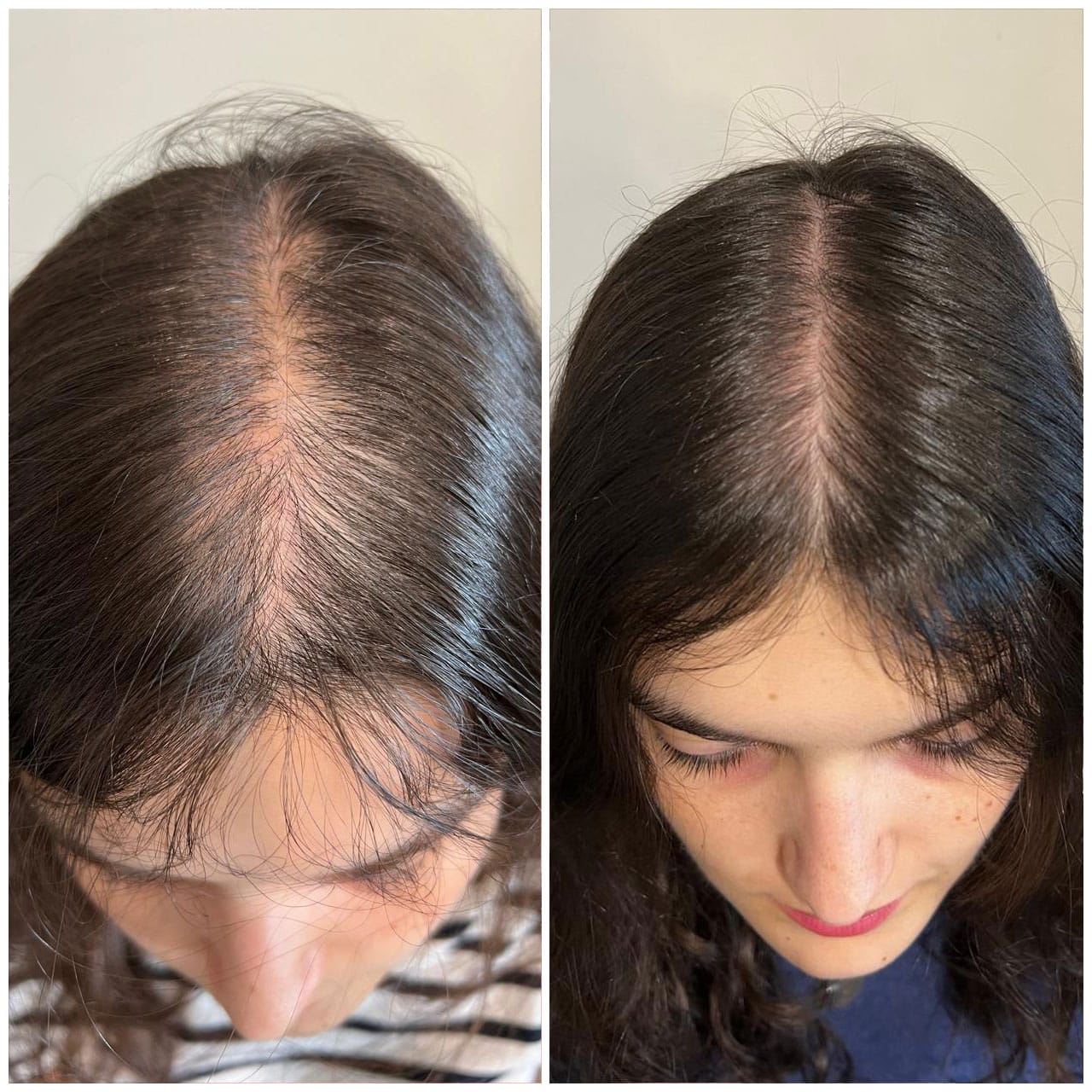 Customer photo review of PDRN Shoot Brush 2x1 Oferta