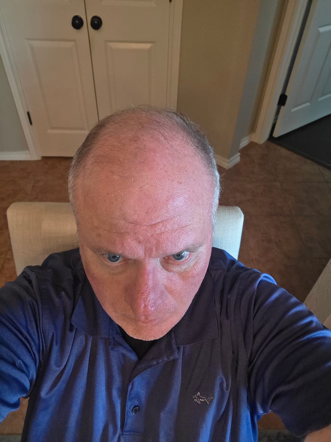 Customer photo review of Spartan™ Root Activator Shampoo 6 Bottles(sc)