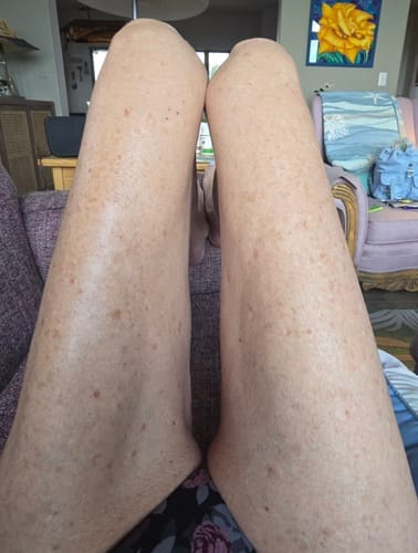 Customer photo review of Tetyana Naturals Body Oil