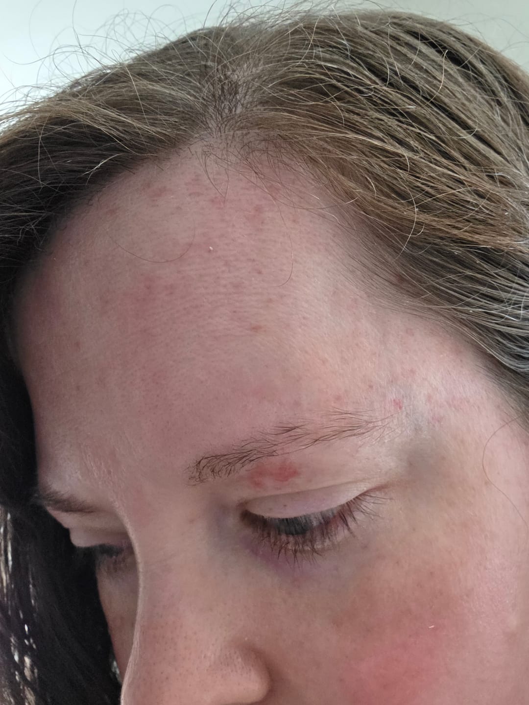 Customer photo review of Blue EGF Intensive Pro Cream