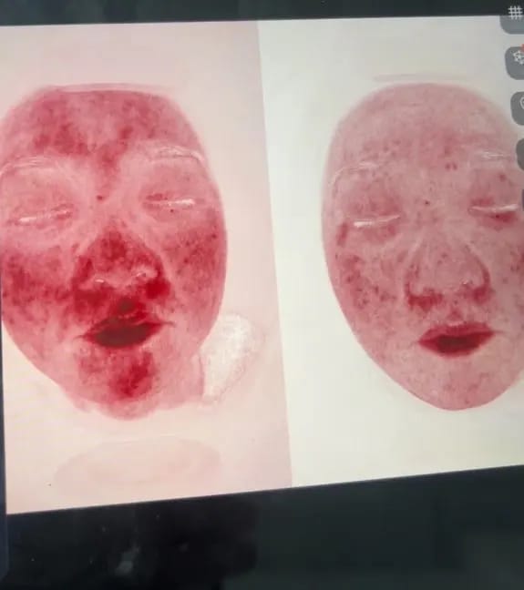 Customer photo review of DermaScope AI Skin Analysis System