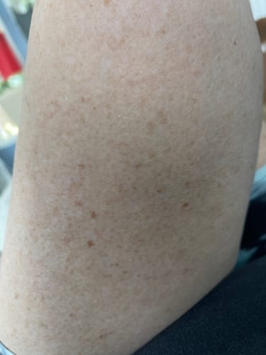 Customer photo review of Tetyana Naturals Body Oil