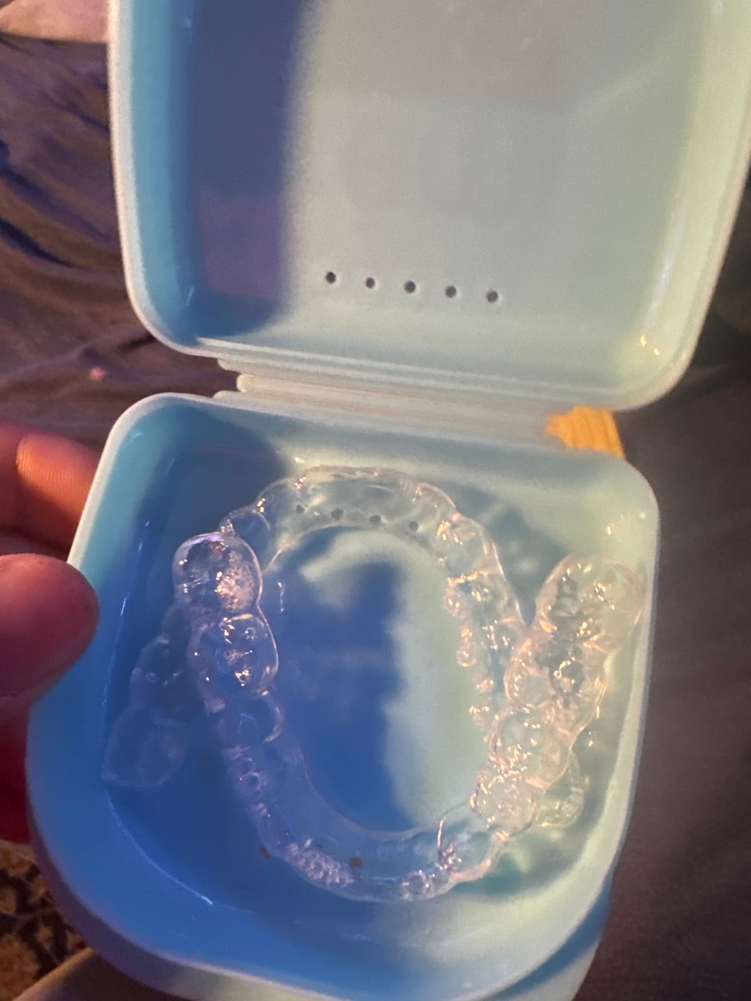Customer photo review of Custom Night Guards