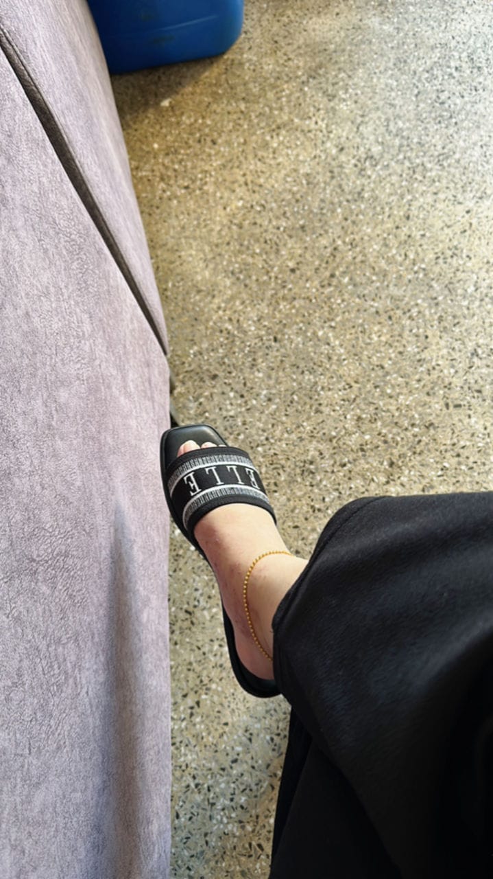 Customer photo review of Renee Logo Stitch Slip-on Sandals In Black