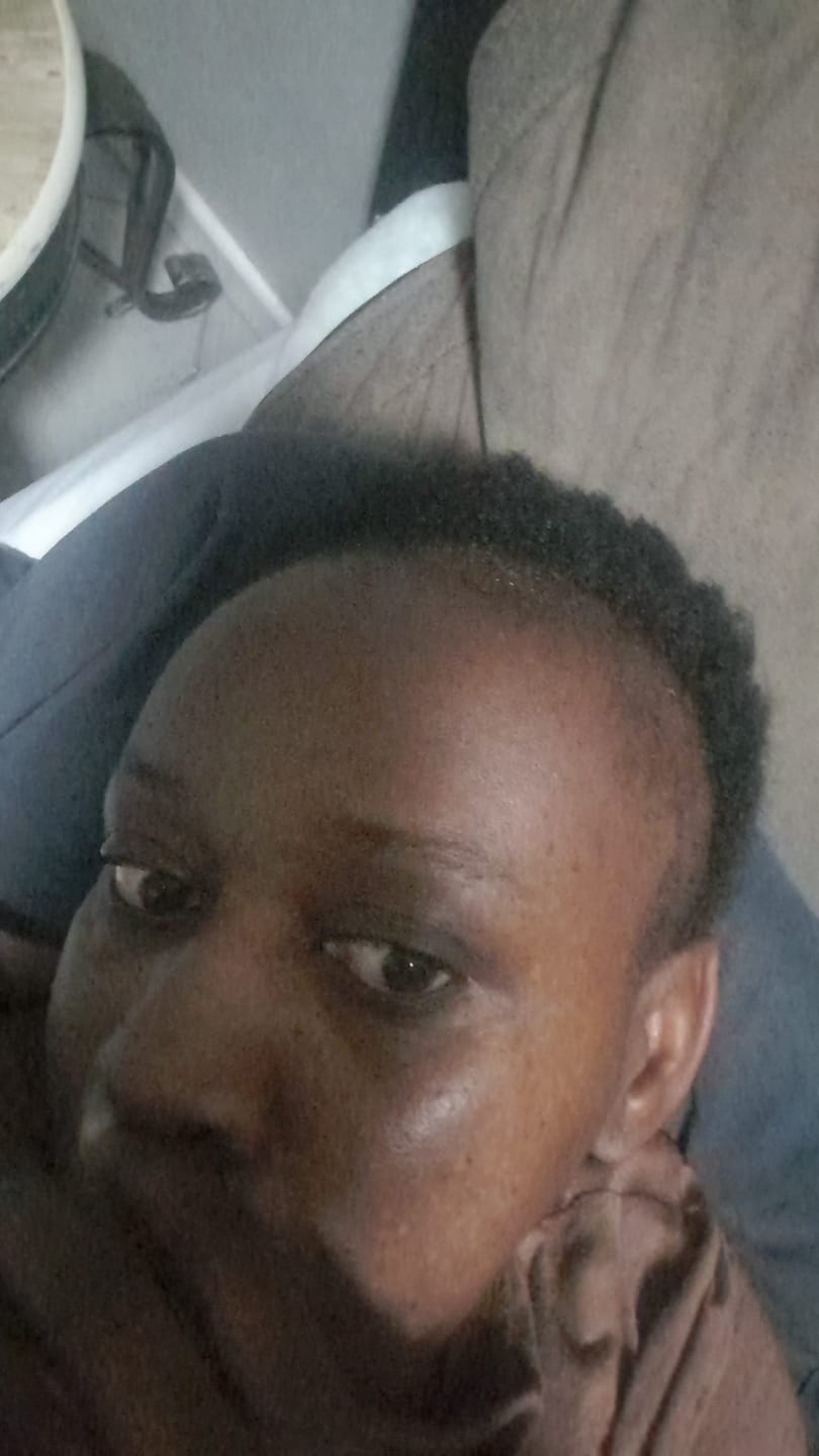 Customer photo review of Scalp Serum Set - Minoxidil