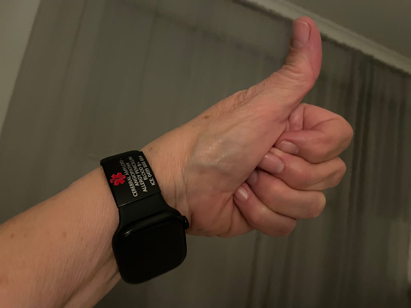 Customer photo review of Personalised ID Tag for Watch Band & Fitness Trackers