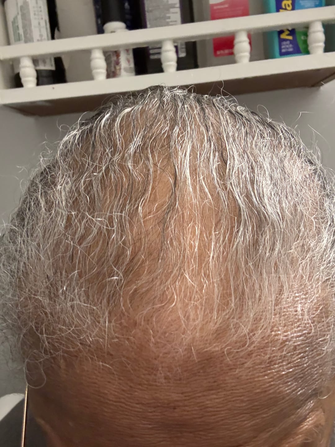 Customer photo review of Moisturize & Seal Bundle